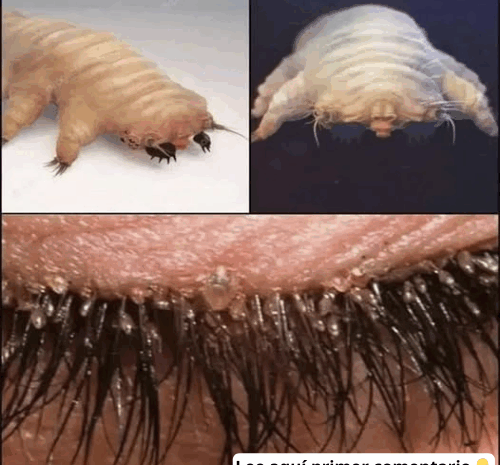 Los Microorganismos Invisibles: ¿Qué Criaturas Viven en Tu Cuerpo y Cómo Afectan Tu Salud?