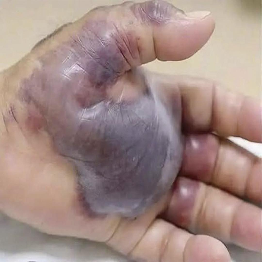 Consecuencias de dormir con el teléfono
