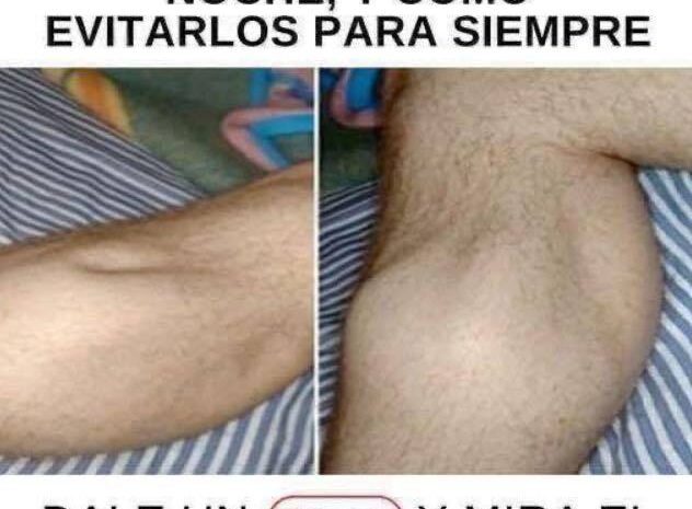 Calambres Nocturnos en las Piernas: Causas y Soluciones Efectivas