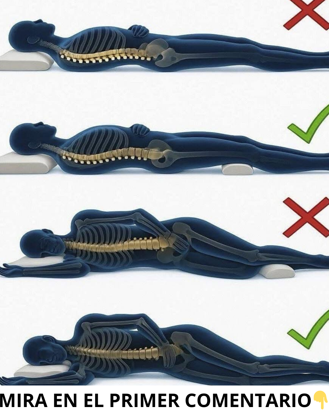 Posiciones para dormir y su efecto en la columna vertebral