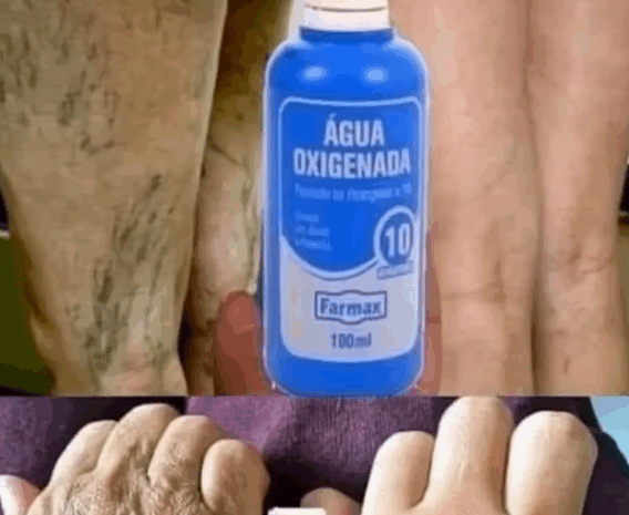 Agua Oxigenada: El Remedio Natural para Manchas y Arrugas en el Rostro