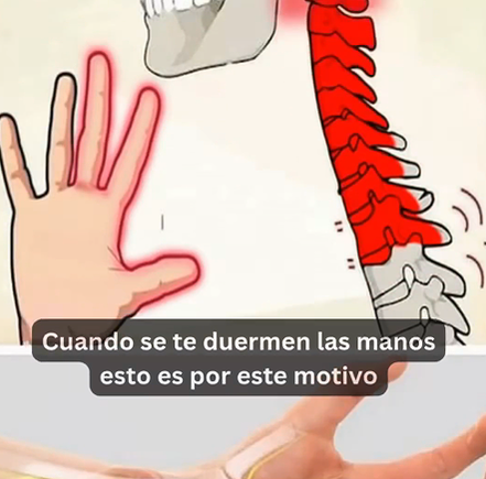 ¿Por Qué se Adormen las Manos? Causas y Remedios Naturales