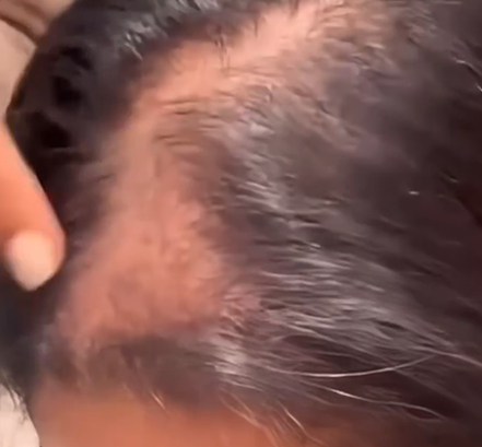 Haz Crecer Tu Cabello con Esta Sencilla Receta Natural