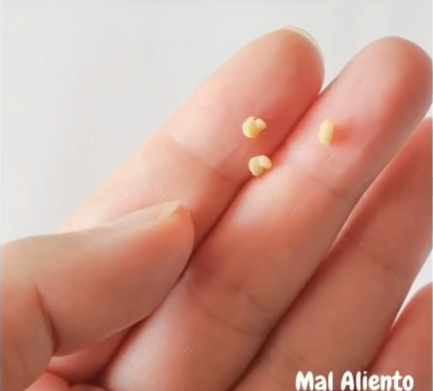 Consejos para combatir el mal olor en la boca
