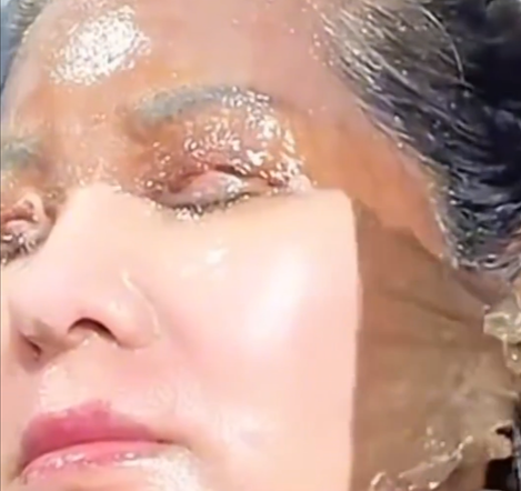 Exfoliación de piel