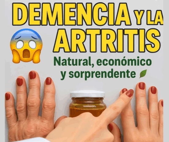 Remedios Caseros para Combatir la Artritis y la Inflamación