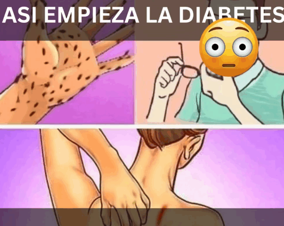 7 Señales de Azúcar Alta en la Sangre y Cómo Manejarla