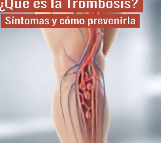 Salud y Trombosis