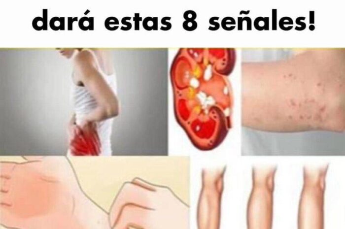 8 Señales de Advertencia de Problemas Renales Que No Debes Ignorar