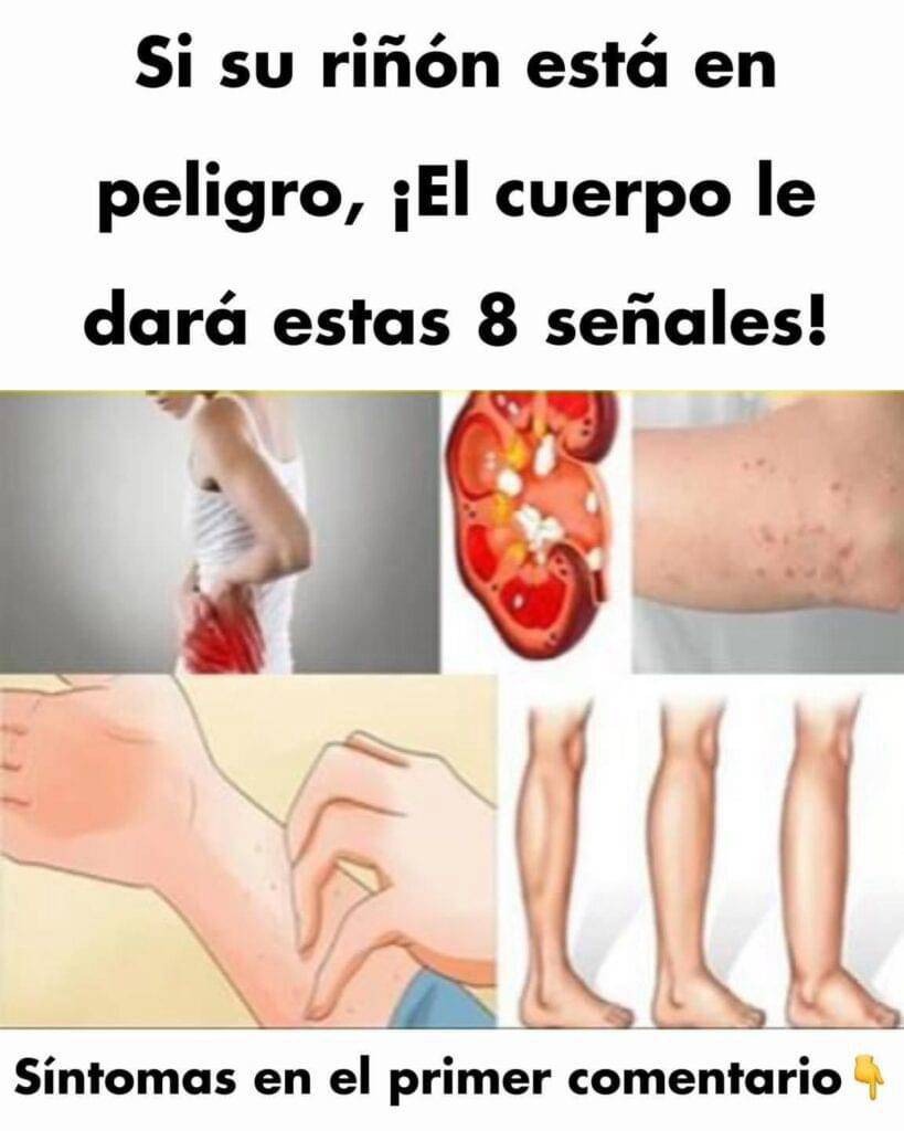 Señales de advertencia problemas renales