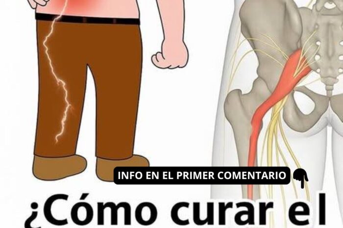 Adiós al Dolor Lumbar y Ciático: Técnicas y Remedios Naturales