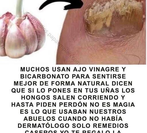 Remedios Naturales para Hongos en las Uñas: Ajo, Vinagre y Bicarbonato