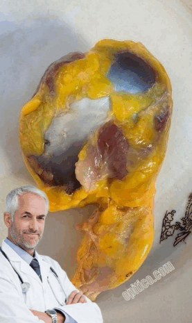 Descubre los Beneficios de la Molleja de Pollo: Un Superalimento Para Tu Salud