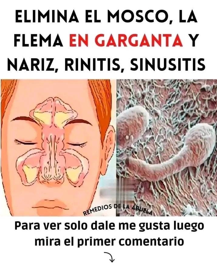 Sistema Respiratorio