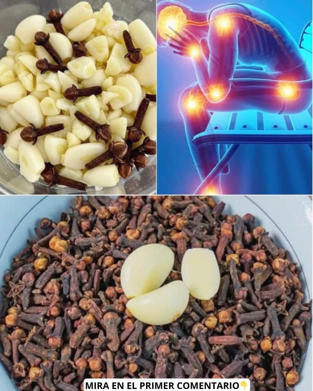 Remedio natural para el dolor en las piernas y várices