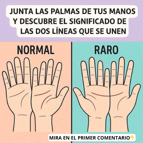Ilustraciones de manos con líneas alineadas y desalineadas