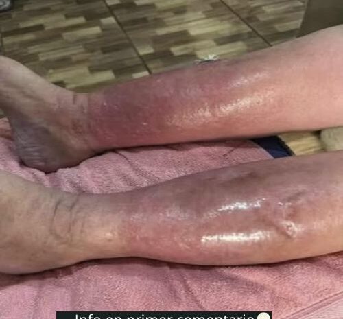 Remedios Naturales para el Cuidado de la Piel: Soluciones Caseras Efectivas