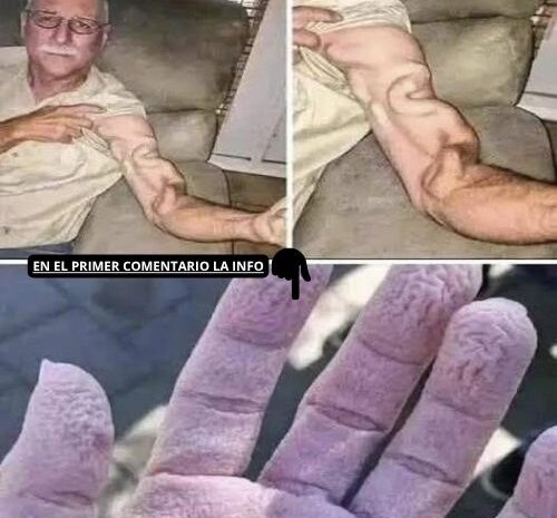 Salud y Bienestar: Cuidados para tus Articulaciones y Brazo