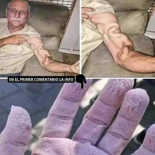 Imagen de Salud del Brazo