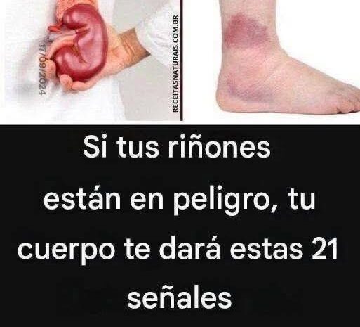 21 Señales de Advertencia de que Tus Riñones Están en Peligro