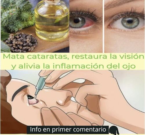 Receta Natural para Aliviar los Ojos Secos y Combatir la Inflamación
