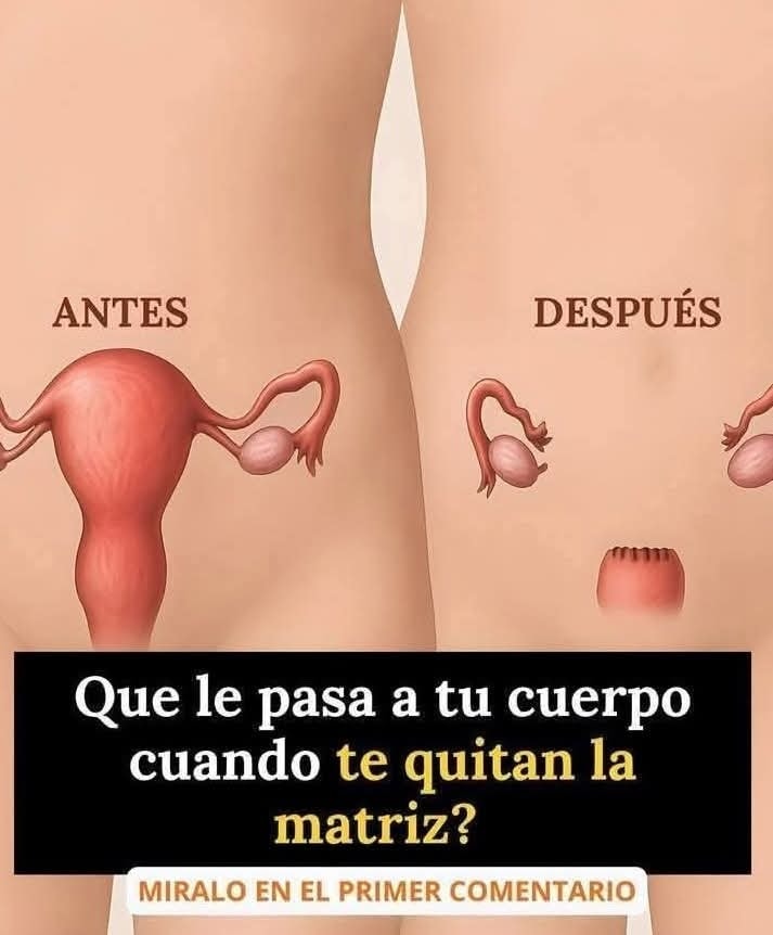 Comparación del área pélvica femenina antes y después de una histerectomía