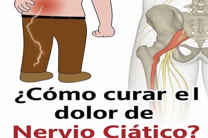 Adiós al Dolor Lumbar y Ciático: Soluciones Naturales y Efectivas