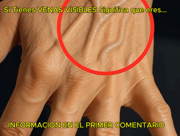 ¿Por Qué Tienes VENAS VISIBLES? Descubre su Significado y Cómo afectan tu Salud