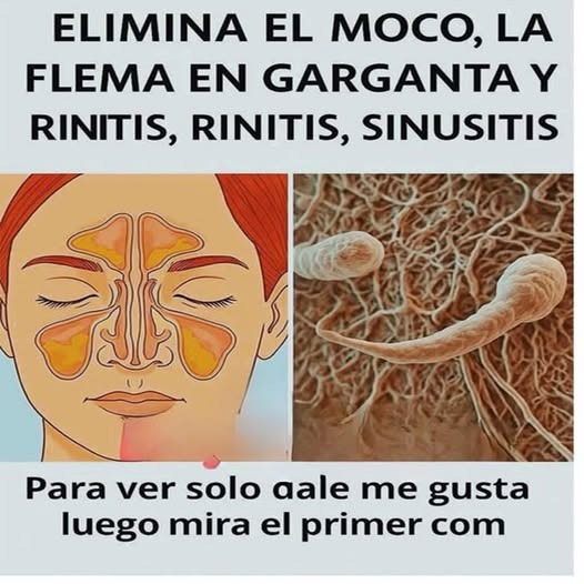 Remedios caseros para problemas respiratorios