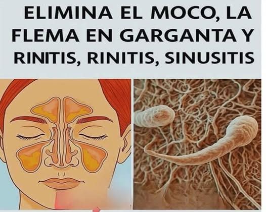 Elimina el Moco y la Flema: Remedios Caseros para Problemas Respiratorios