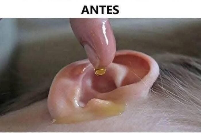 Echa 4 Gotas en Tu Oído: ¡Recupera Tu Audición con Este Remedio Natural!