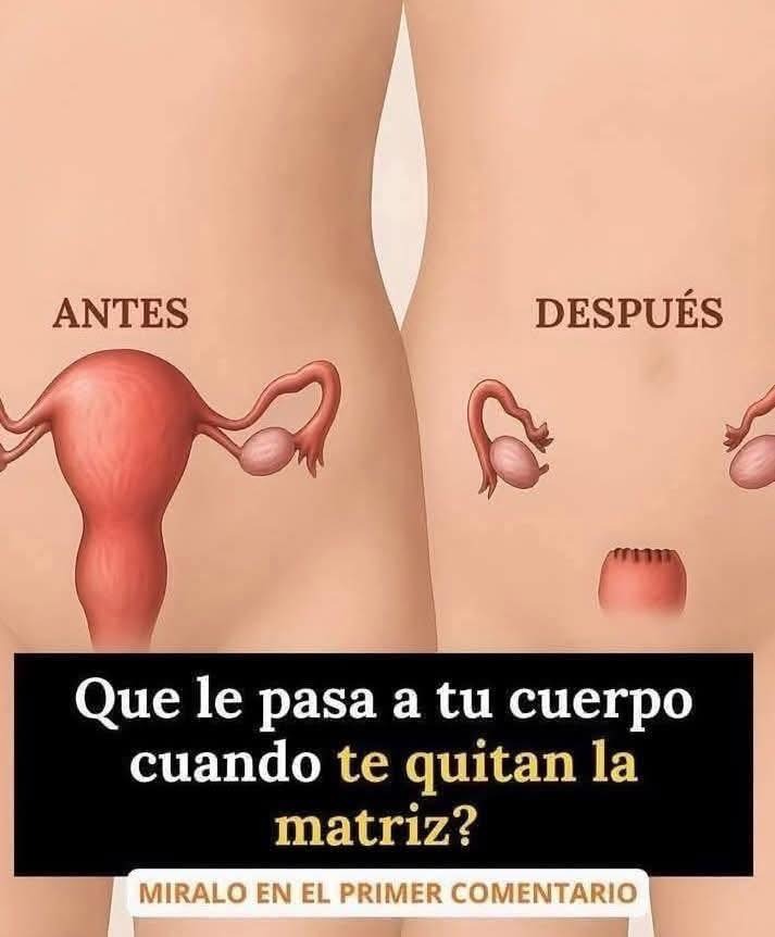 Comparativa antes y después de una histerectomía