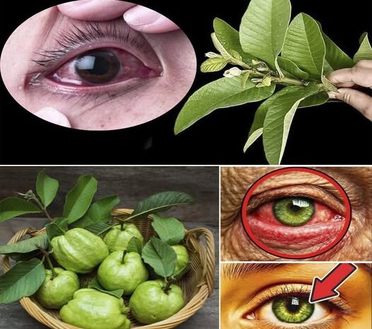 Cómo Usar la Guayaba para Tratar Problemas Oculares: Remedios Naturales para los Ojos