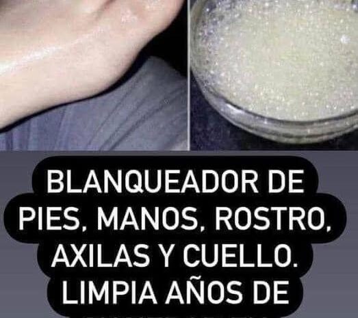Remedios Caseros para Aclarar Axilas, Codos y Rodillas