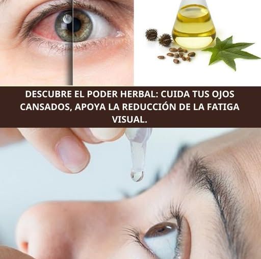 Cuidado de los ojos cansados con remedios naturales