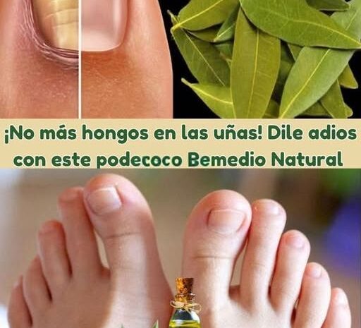 Dile Adiós a los Hongos en las Uñas con este Poderoso Remedio Natural