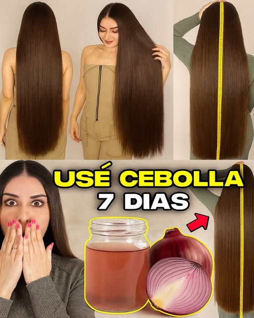 Usé Cebolla en el Cabello