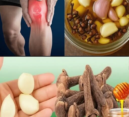 Alivia el Dolor de Piernas con un Remedio Natural: Ajo, Clavo de Olor y Miel