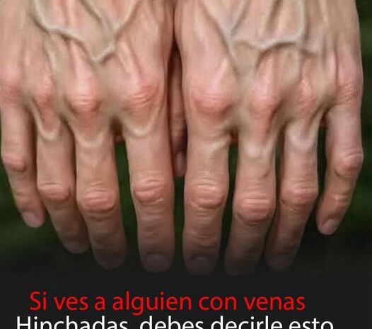 Venas Visibles en las Manos: Causas y Consejos de Cuidado