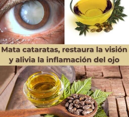 Remedio Natural para Cataratas: Hidrata y Revitaliza tu Visión