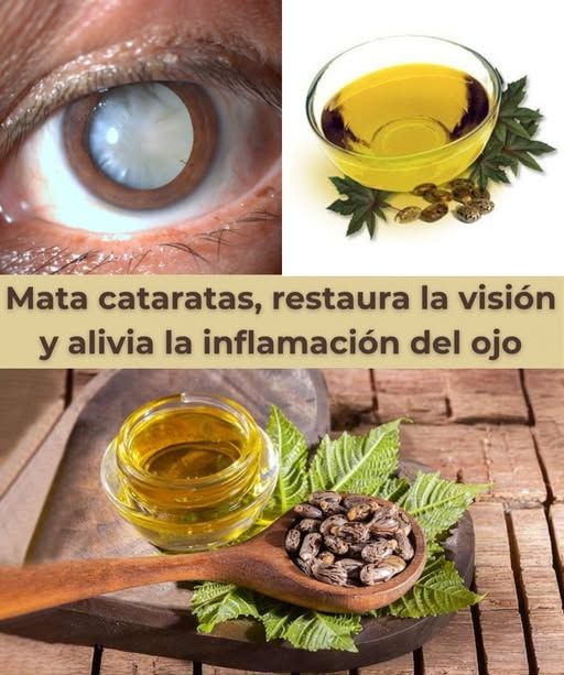 Remedios naturales para cataratas