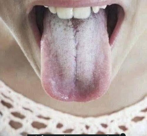 La Salud Reflejada en Tu Lengua: Colores y Significados que No Puedes Ignorar