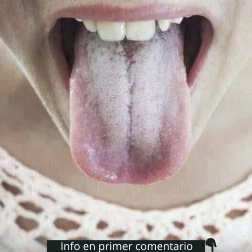 Lengua extendida