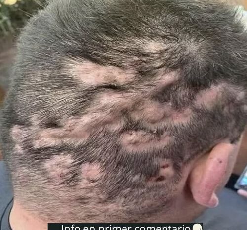 Primeros Síntomas de Enfermedades y Remedios Naturales para Aliviarlos