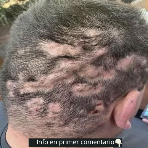 Síntomas comunes y remedios