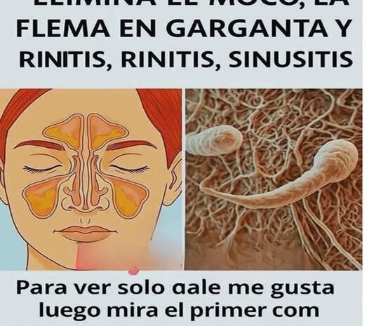 Elimina el Moco y la Flema: Remedios Caseros para Problemas Respiratorios