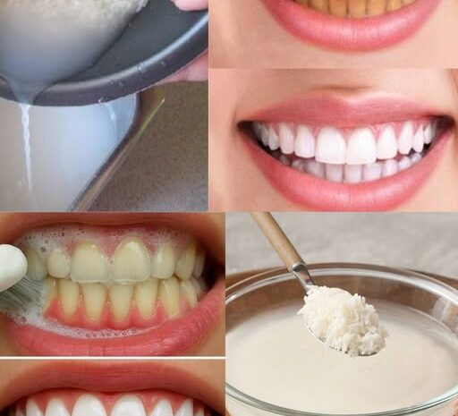 Elimina el Sarro y Blanquea tus Dientes con Agua de Arroz