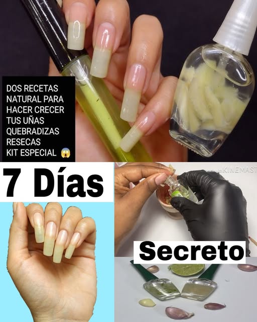 Remedios Naturales para Uñas