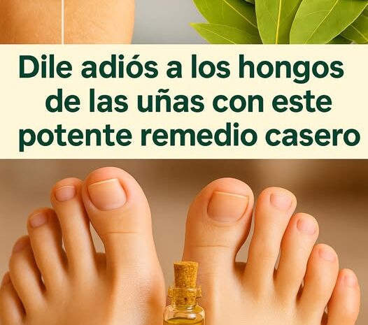 Dile adiós a los hongos con este poderoso remedio natural
