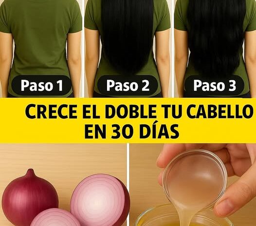 Aceite de Cebolla para Crecer Cabello y Prevenir Caída